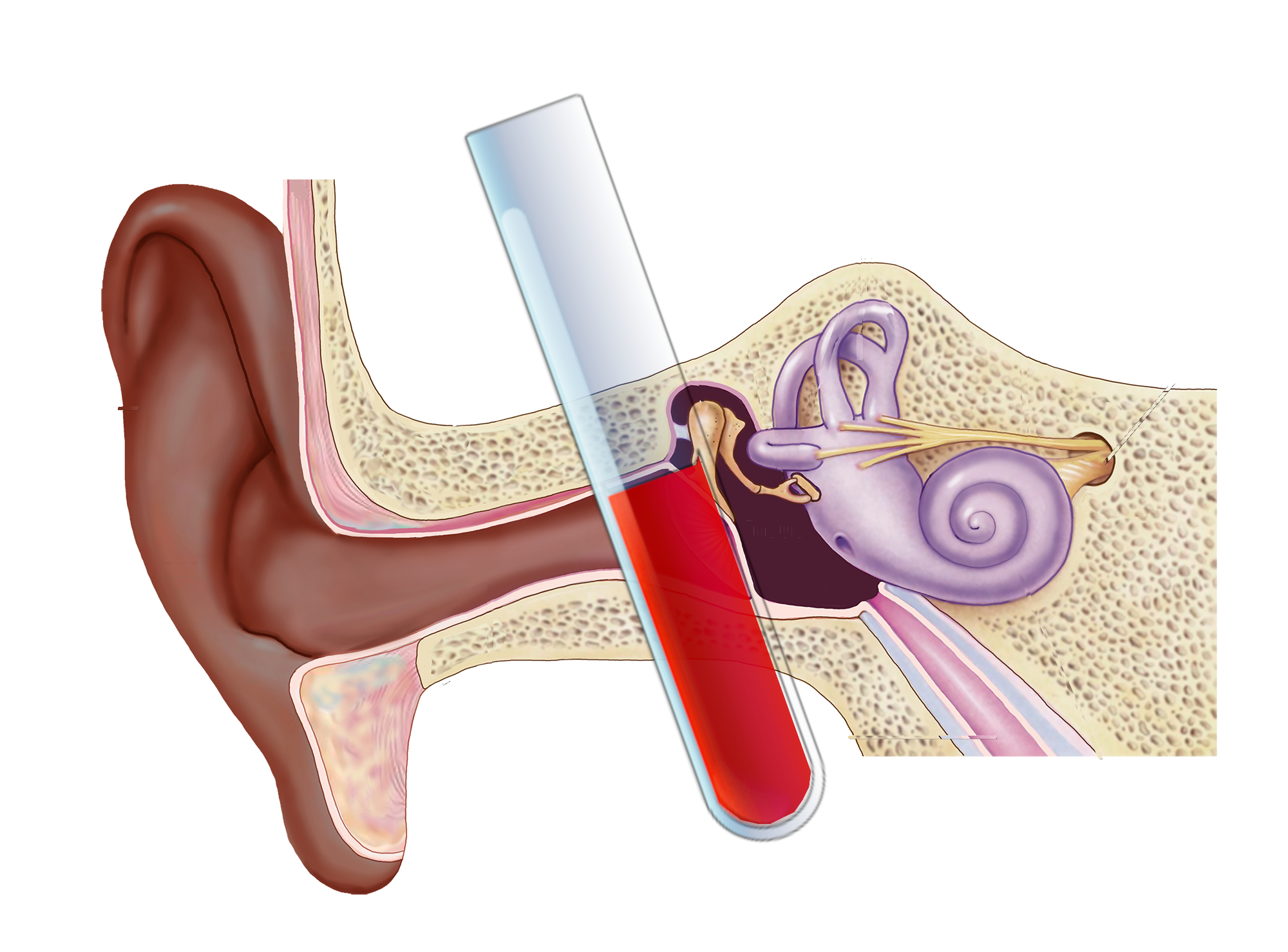 Links to 9 Trials Suggesting Platelet Rich Plasma Is Safe And Effective For Hearing Loss